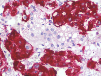 STMN4/RB3 Antibody