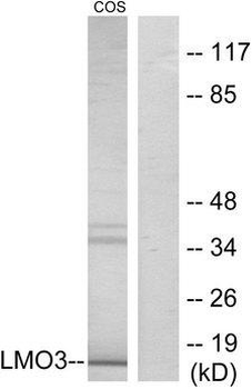 DAT1/LMO3 Antibody