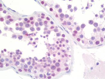 TRMT2A Antibody