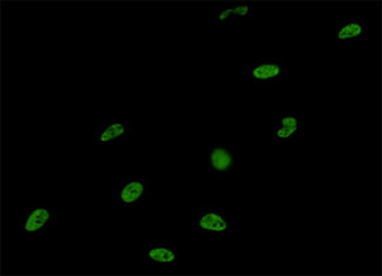 SNRPA / U1A Antibody (clone 3F9-1F7)