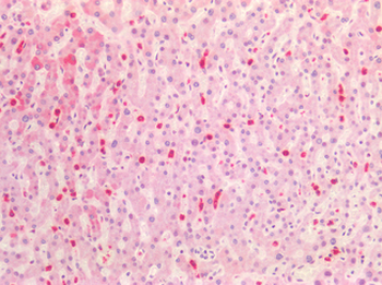 HNE / Neutrophil Elastase Antibody