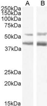 Anti-CCR4 [KW-0761 (Mogamulizumab)]
