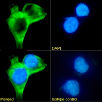 Anti-Tau Oligomeric complex [TOC1]