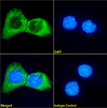 Anti-BRAF V600E protein [600E-7]