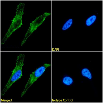 Anti-Integrin alpha 5 beta 1 [SG/19]