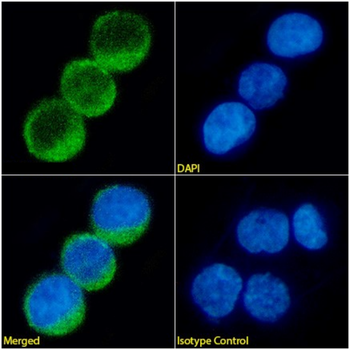 Anti-CD23 [IDEC-152 (Lumiliximab, 6G5) ]