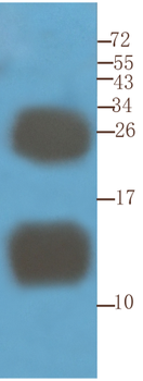 Anti-CD52 [YTH 34.5-G2b (Campath-1G)]