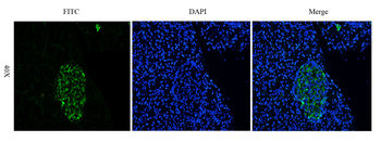 Anti-carcinoembryonic antigen (CEA) [Arcitumomab]