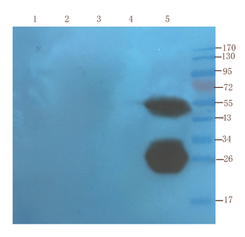 Anti-TNF alpha [cA2 (Infliximab)]