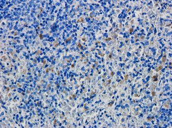 Anti-CD19 [FMC63]