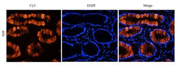 Anti-Tumor associated glycoprotein (TAG) 72 [B72.3 (Satumomab)]