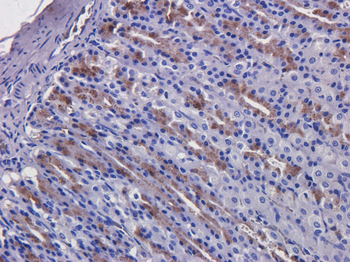 Anti-EGFR [C225 (Cetuximab)]