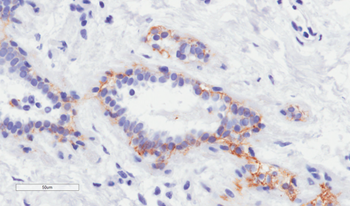 Anti-erbB-2 (Her-2/neu) [4D5-8 (trastuzumab)]