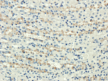 Anti-Complement Receptor 1 & 2 [7G6]