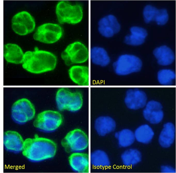 Anti-CD3 epsilon [OKT-3 (muromonab)]