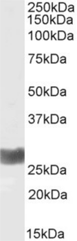 Anti-IFN gamma [D9D10]