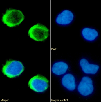 Anti-CD154 [IDEC-131 (Toralizumab)]