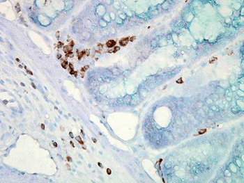 HSP70 Antibody: Biotin