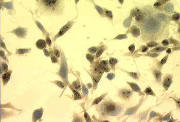 HSP70 Antibody (RPE)