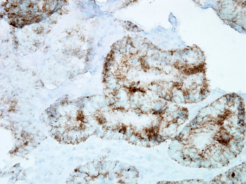 HSP60 Antibody (FITC)