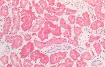 HSP60 Antibody (RPE)