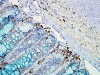 HSP90 Antibody (PerCP)