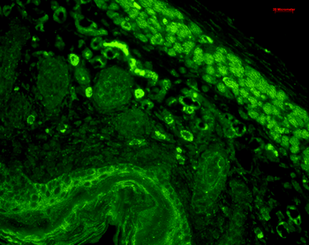 CD74 Antibody (APC)