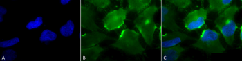 CD74 Antibody: RPE