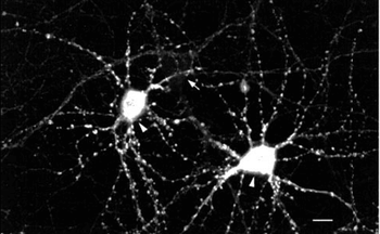 CaMKII Antibody: APC