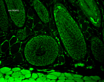 FKBP52 Antibody (RPE)
