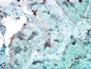 HSP90 Antibody (HRP)