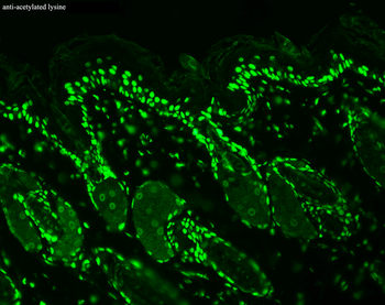 Acetylated Lysine Antibody: HRP