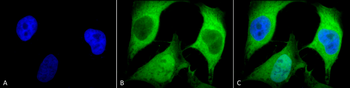 Ubiquitin Antibody: FITC