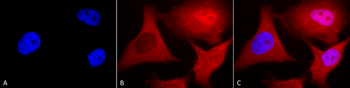 Ubiquitin Antibody: FITC