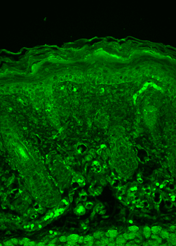 Rhodopsin Antibody: APC
