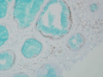 DNMT1 Antibody: APC