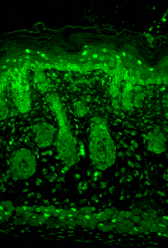 Kir2.1 Antibody (RPE)