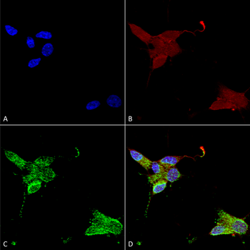 TRPM7 Antibody (PerCP)