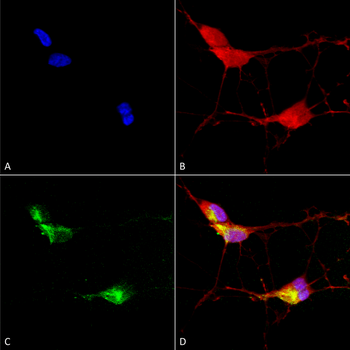 TRPV3 Antibody (RPE)