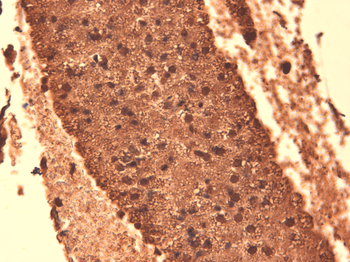 Sodium-Iodide Symporter Antibody: Biotin