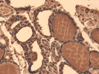 Sodium-Iodide Symporter Antibody: FITC