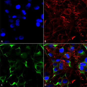 SLC38A1 Antibody (HRP)