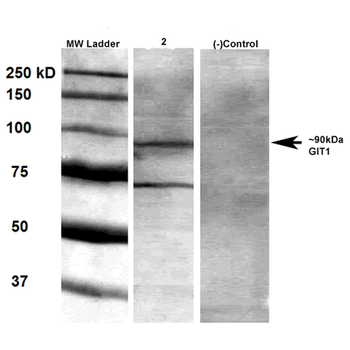 GIT1 Antibody (Biotin)