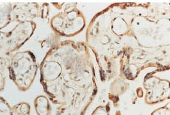 SOD (Cu/Zn) Antibody: PerCP