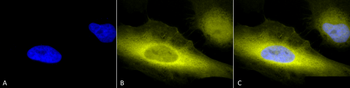 Ubiquitin Antibody: APC