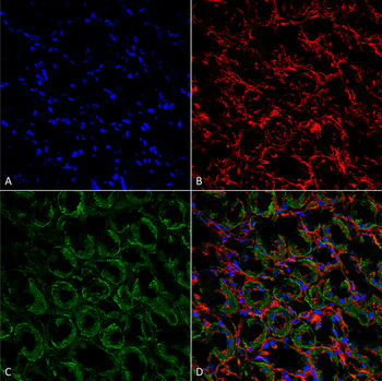 ENaC alpha Antibody: FITC
