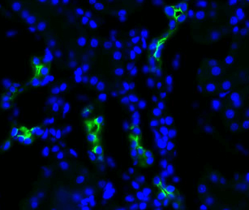 Aquaporin 2 Antibody: FITC