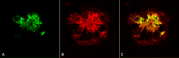 Amyloid Oligomers (A11) Antibody: FITC