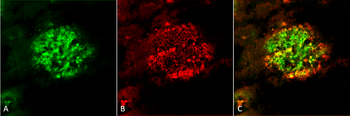 Amyloid Fibrils (OC) Antibody: HRP