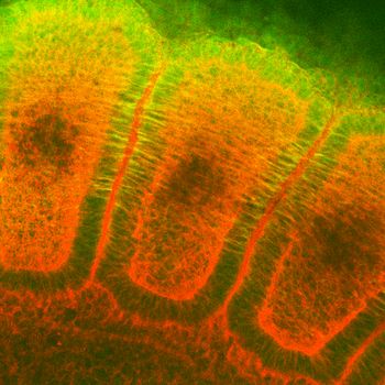 HSP25/HSP27 Antibody: Biotin